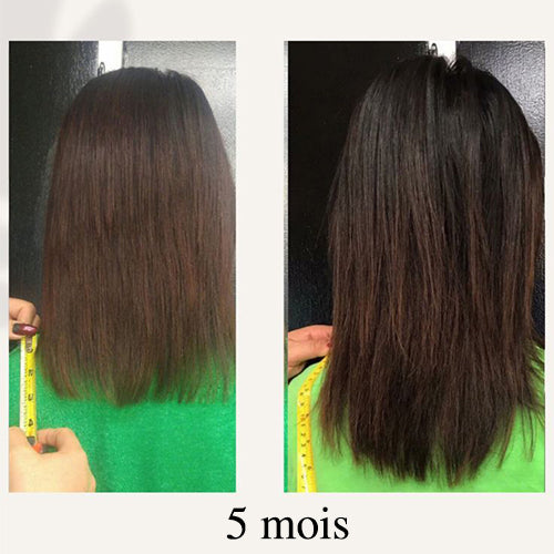 Résultat sur femme aux cheveux longs bruns après 5 mois de traitement capillaire, montrant une longueur accrue et des cheveux plus épais mesurés avec ruban, effet densité visible