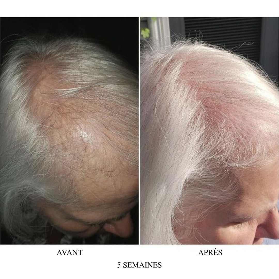 ACTIIV Femme shampoing RECOVER épaississant